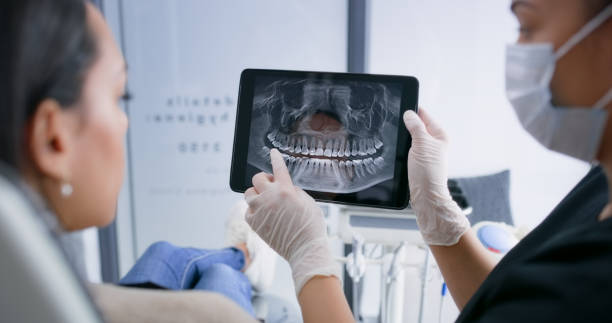 Licensed Tooth Extraction service in Madison, NJ - Smile Center Dentistry